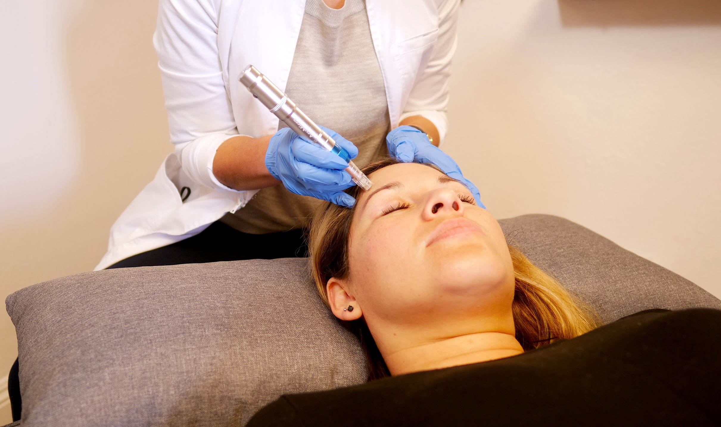 A photograph showing a patient resting supine while the acupuncturist uses a microneedling pen to reduce fine lines on her forehead.